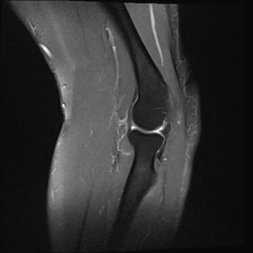 Click on the Serie image to view the images of Wieszt, Gnter